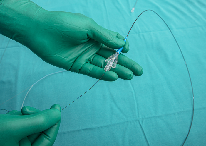 Catheter Design and Material Considerations for Sensors